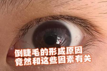 眼睛是倒八字