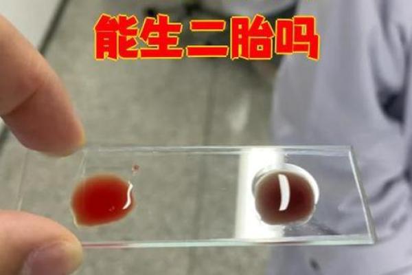 o型血是稀有血型吗 O型血稀有吗
