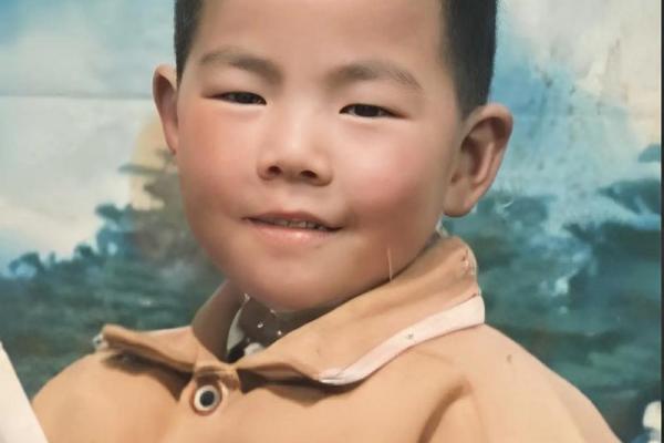 额头上的胎记算命