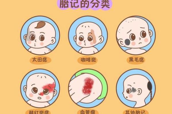 脸上胎记算命看出命运