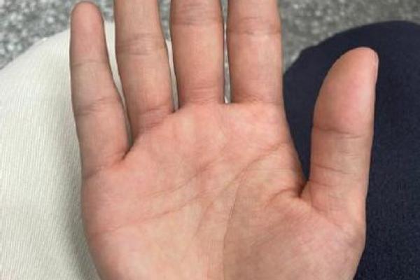 风水解读感情线断开上下两条好不好