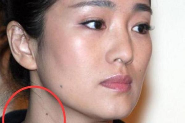 据脖子上胎记算命，有什么说法