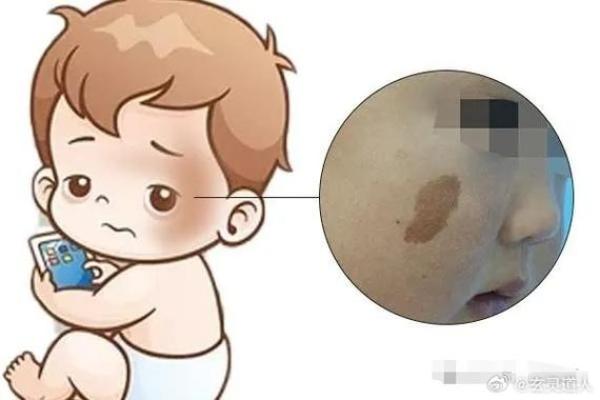 据脖子上胎记算命，有什么说法