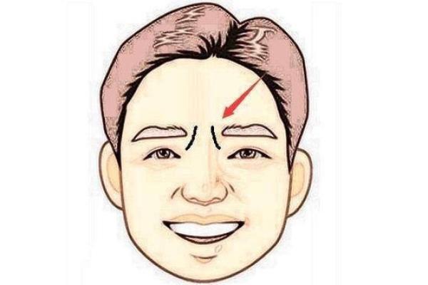 印堂八字纹的男人财运好吗