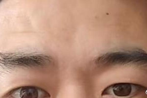 八字眉眉尾下垂的男人