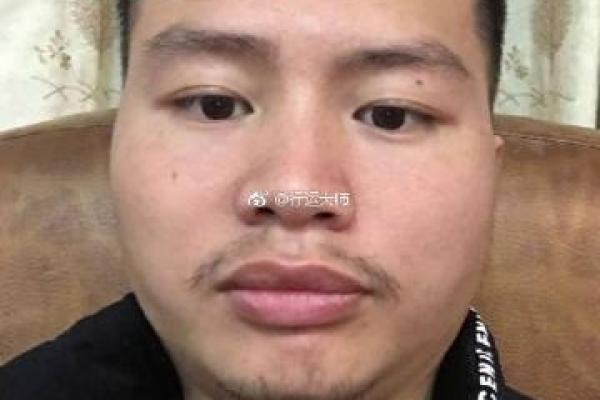 风水额头窄的男人是穷命