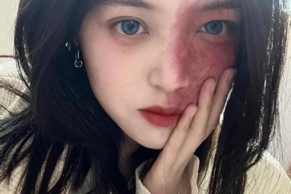 看脸上胎记如何算命