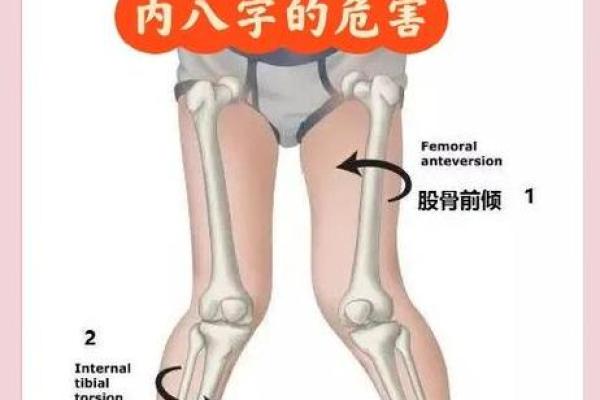 八字脚是什么