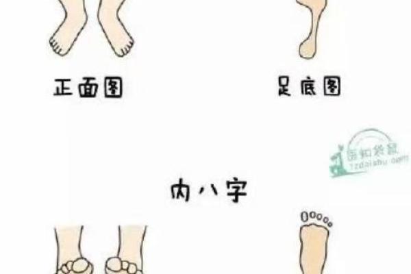 外八字纠正