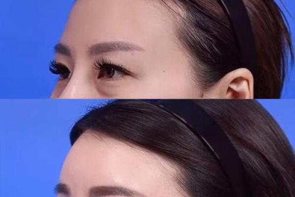 八字与皮肤 八字影响肤质