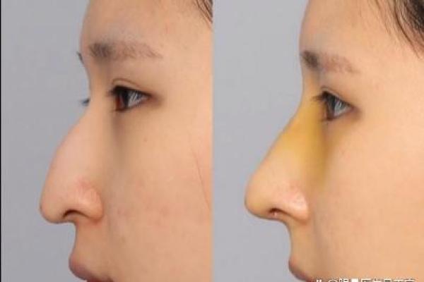 面相风水鹰钩鼻女人的好处和缺点