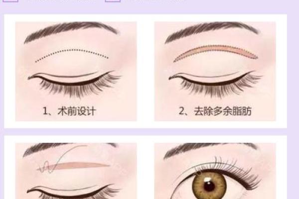 割双眼皮忌讳什么风水