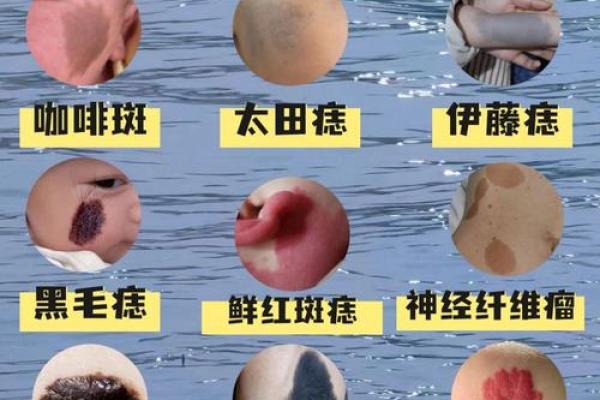 胎记算命图,后背胎记全面图解